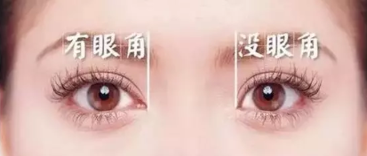 開(kāi)眼角上的傷口大概多久能才愈合