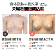 昭通做自體脂肪豐胸，怎么提高脂肪存活率