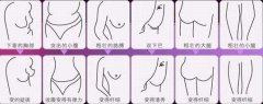 沈陽(yáng)做抽脂減肥費(fèi)用是多少