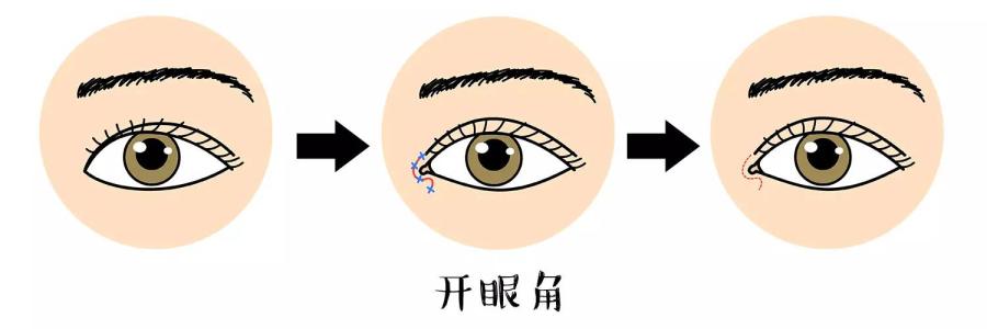 開眼角