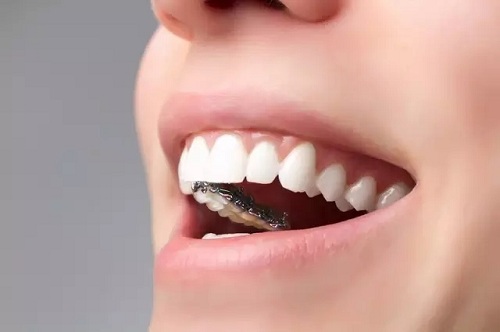 <a href='/suz/' target='_blank'><u>蘇州美萊</u></a>矯正牙齒能提升顏值？是真的！