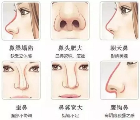 鼻子問題？！過年“萊”轉(zhuǎn)運~