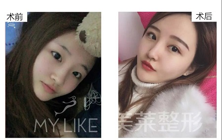 美萊特邀整形醫(yī)師—卜勝利主任，3月4日親診石家莊美萊。