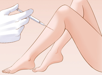 瘦腿大概的價(jià)格？