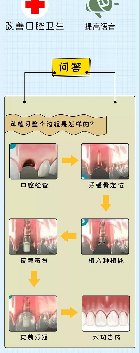 牙齒矯正可以用一輩子嗎？