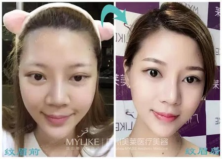 水光、紋眉