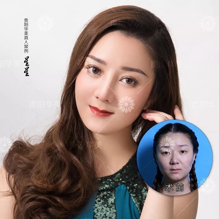【真人秀】貴陽小熱巴，原來整容以前長這樣~