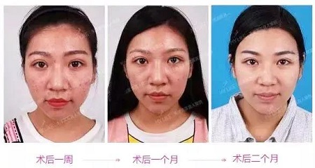 水光