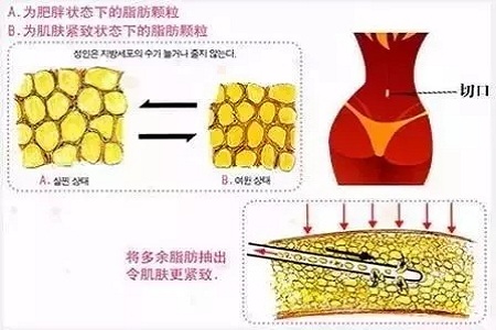 四月不吸脂，五、六、七月徒傷悲......