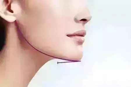 從“側(cè)顏癱”到“側(cè)顏殺”，其實(shí)只需要一點(diǎn)小改變