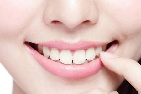 醫(yī)美白皮書：你以為別人潔白整齊的牙齒都是天生嗎？