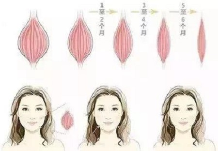 瘦臉