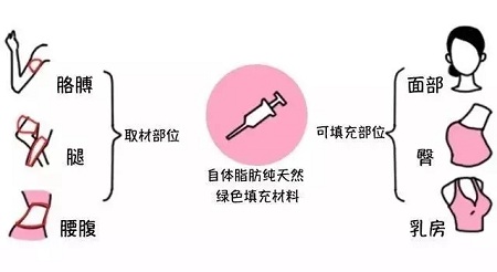 腿再瘦一點？腰再細一點？胸再大一點？自體脂肪填充，一步到位！