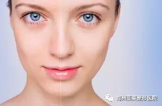 25歲以后，這些醫(yī)美項目可比你們的所有護膚品都強！