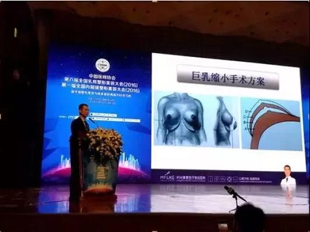 如果你認(rèn)識栗勇，你一定知道假體隆胸