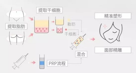 美萊實驗室：瘦臉、ReFa都解決不了你的臉大問題交給我就對了