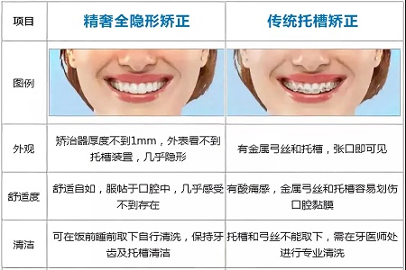 這種牙齒矯正方式，96%的人都會選擇！
