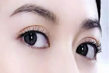 問診室：做完雙眼皮眼睛真的會變大嗎？