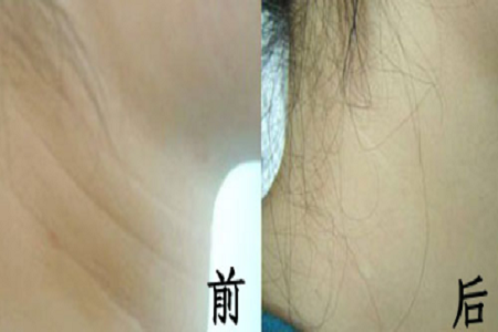 悄咪咪的年輕十歲，撫平頸紋一起“嗨”