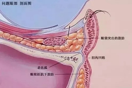 顯老淚溝，你還要任其放肆嗎？