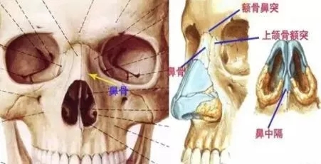 側(cè)面看鼻梁不矮,正面看鼻子卻很塌是什么原因？