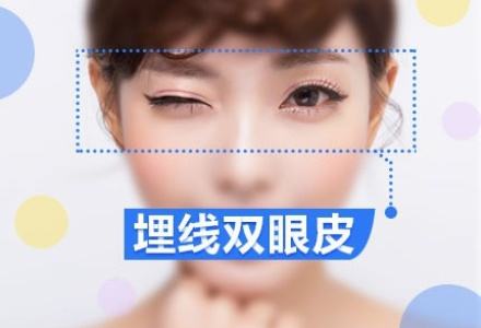 埋線(xiàn)雙眼皮需要多少錢(qián)