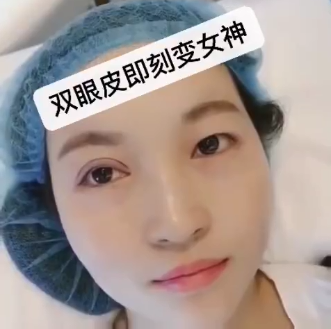 天津美萊不做雙眼皮，你永遠不知道自己會有多美