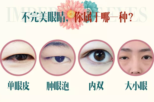 鄭州美萊整形雙眼皮多少錢？