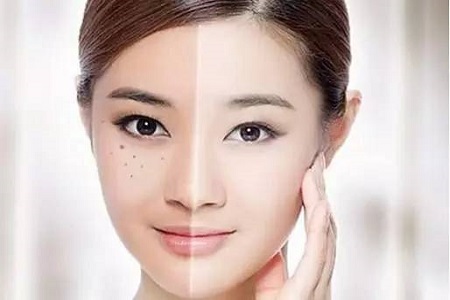 臉部皮膚美白多少錢(qián)