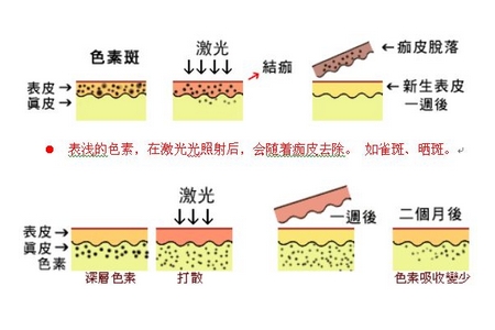 祛斑方法有哪幾種？這些祛斑小妙招你需要掌握